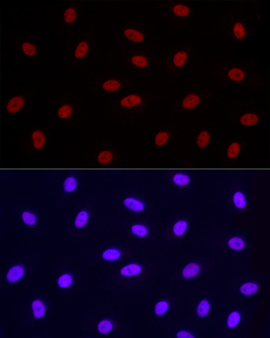 Phospho-POLR2A CTD-S2 Rabbit mAb