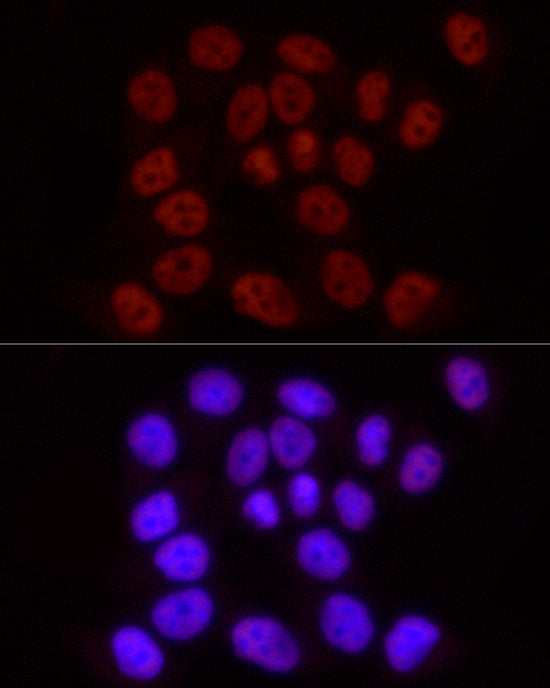 Phospho-POLR2A CTD-S2 Rabbit mAb
