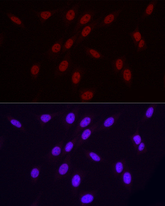 Phospho-POLR2A CTD-S2 Rabbit mAb