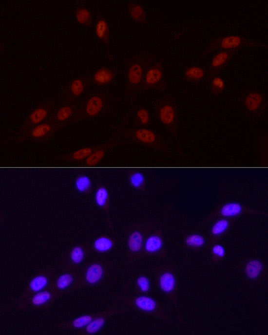 Phospho-POLR2A CTD-S2 Rabbit mAb