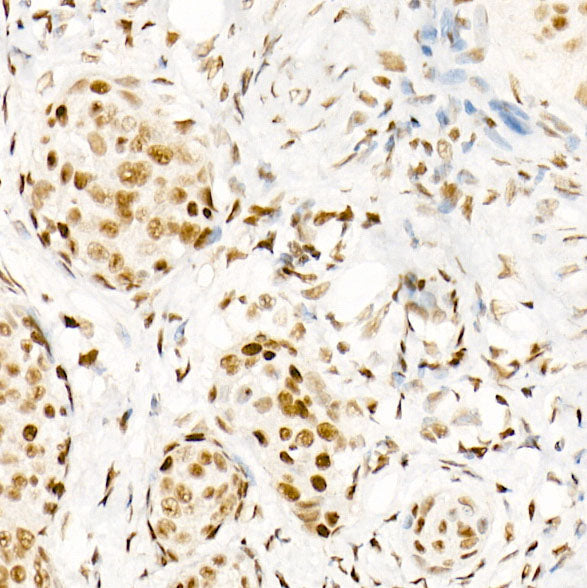 Phospho-POLR2A CTD-S5 Rabbit mAb
