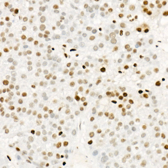 Phospho-POLR2A CTD-S5 Rabbit mAb