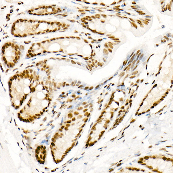 Phospho-POLR2A CTD-S5 Rabbit mAb