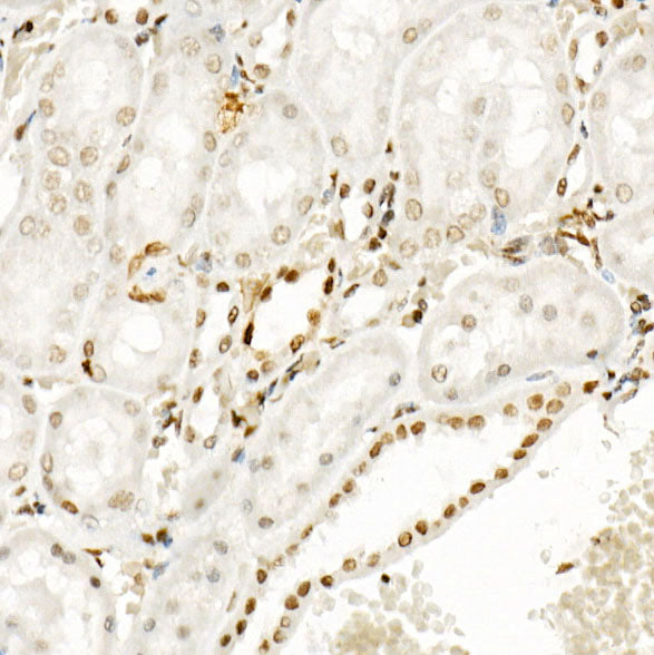 Phospho-POLR2A CTD-S5 Rabbit mAb