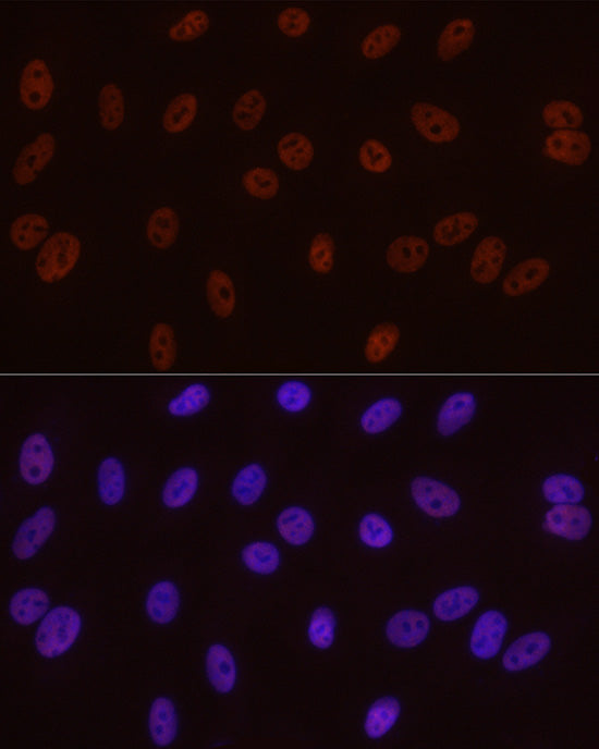 Phospho-POLR2A CTD-S5 Rabbit mAb