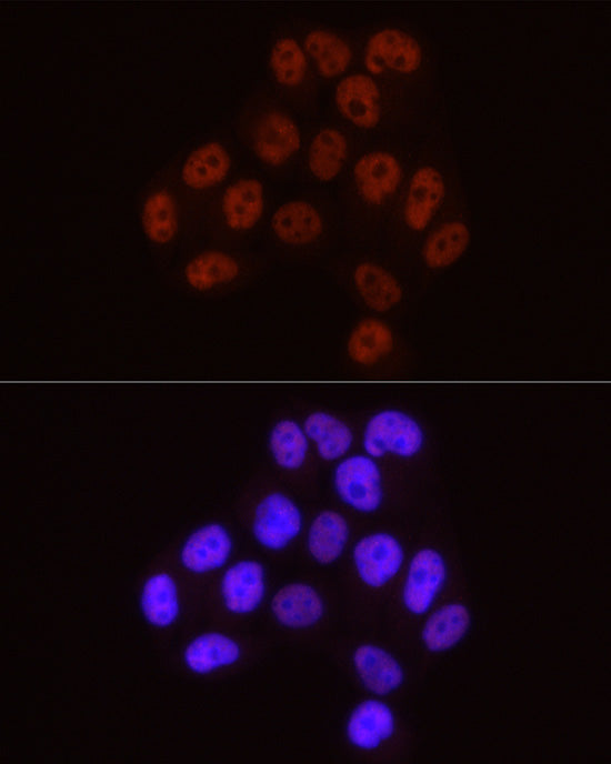 Phospho-POLR2A CTD-S5 Rabbit mAb