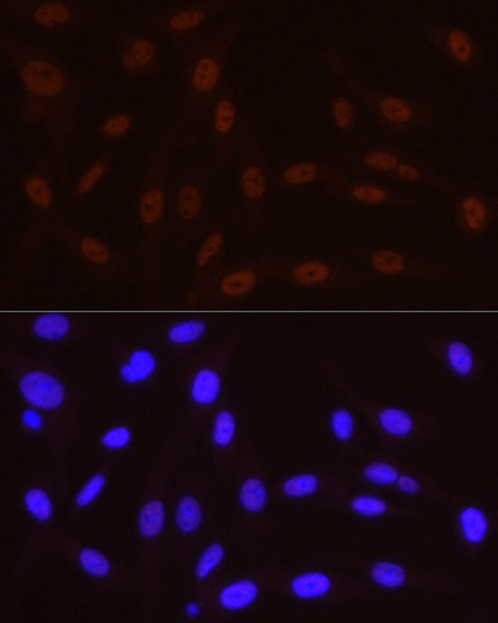 Phospho-POLR2A CTD-S5 Rabbit mAb
