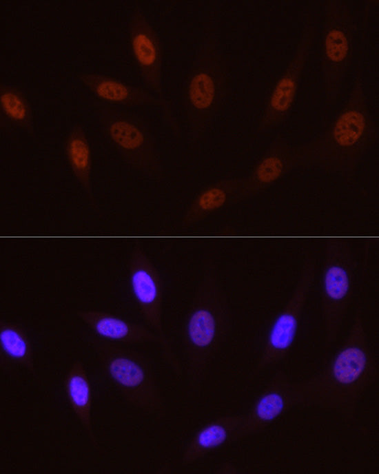 Phospho-POLR2A CTD-S5 Rabbit mAb