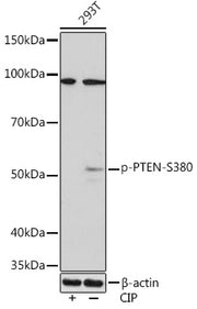 Phospho-PTEN-S380 Rabbit mAb