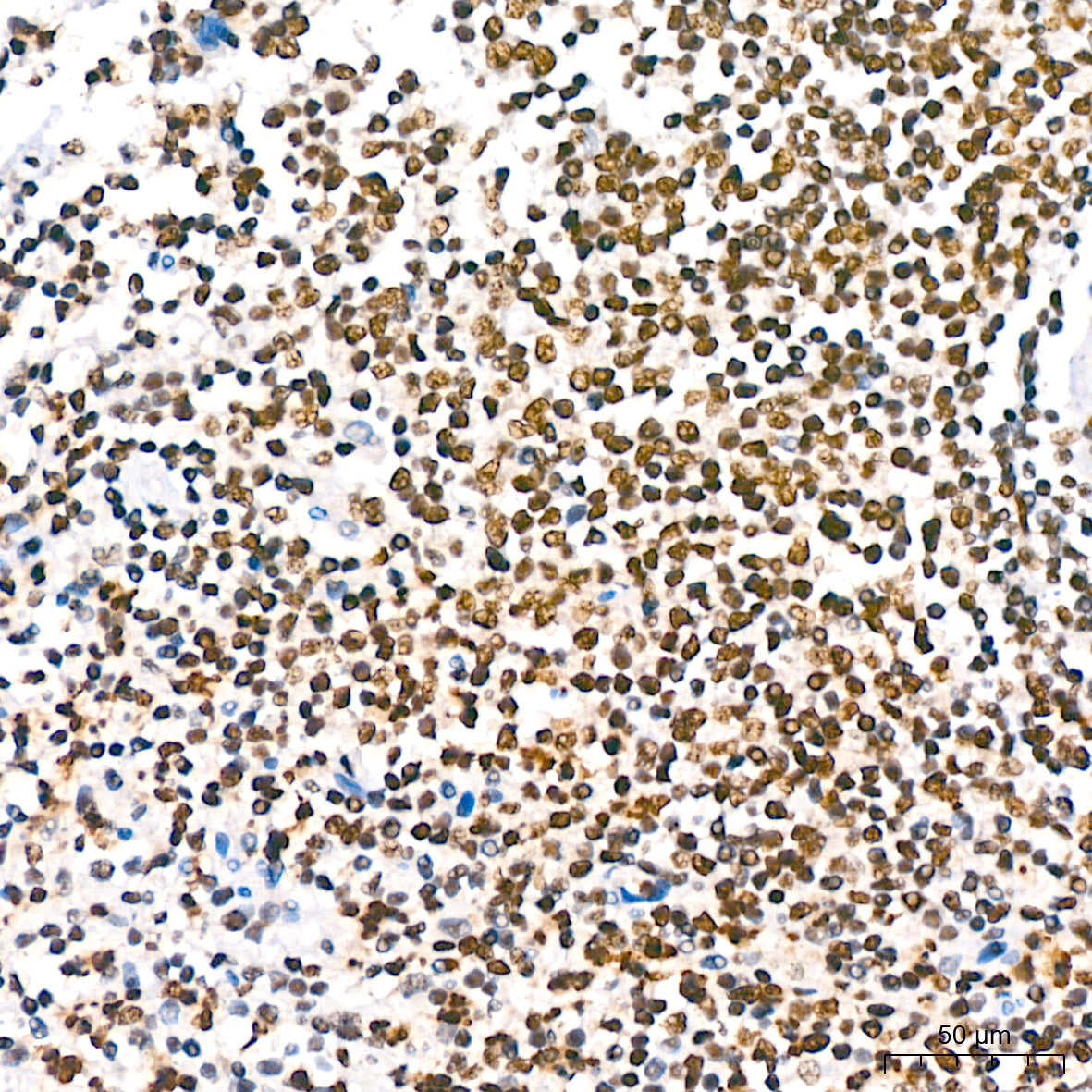 Phospho-IκBα-S36 Rabbit mAb