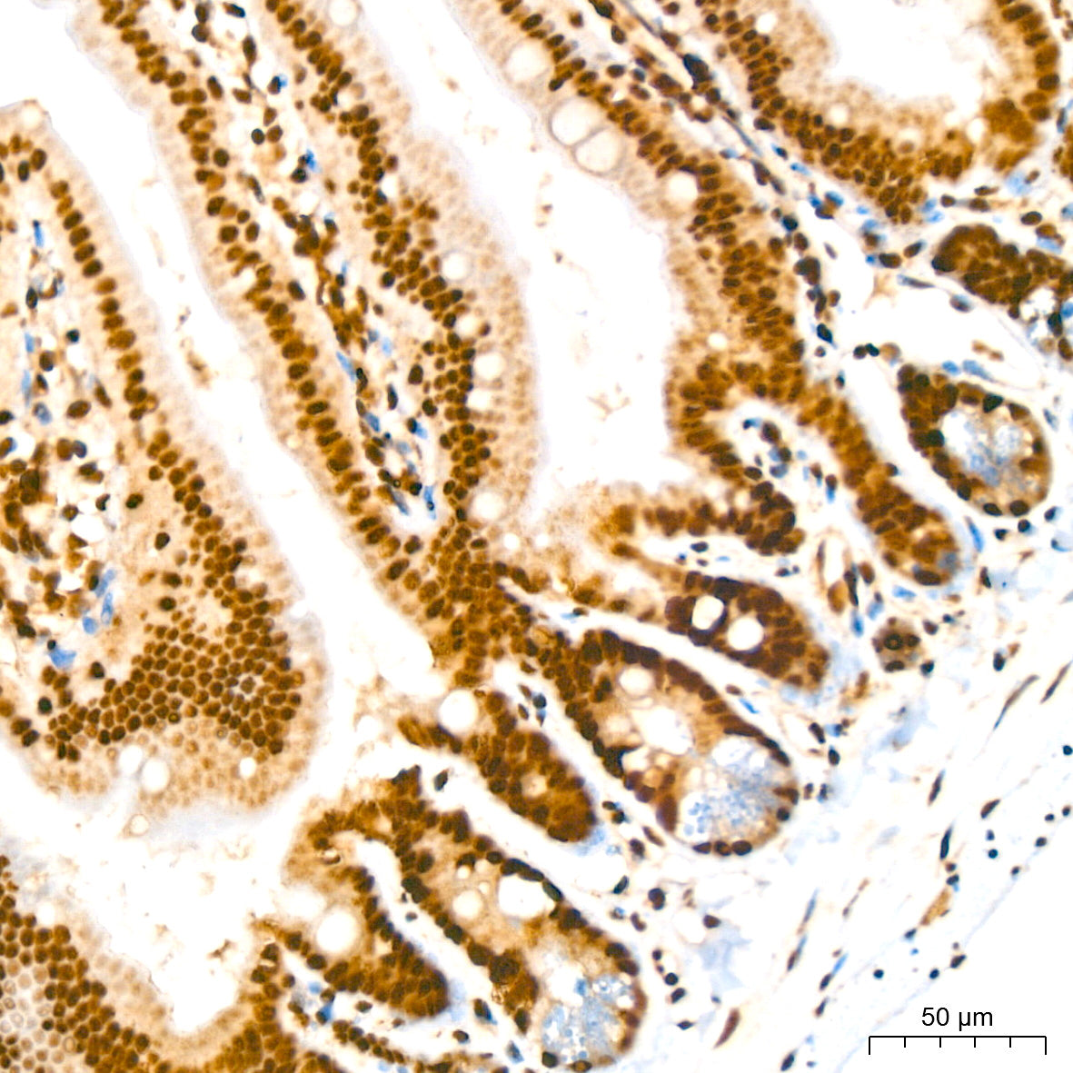 Phospho-IκBα-S36 Rabbit mAb