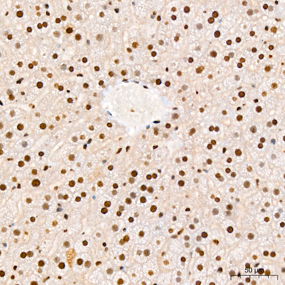Phospho-IκBα-S36 Rabbit mAb