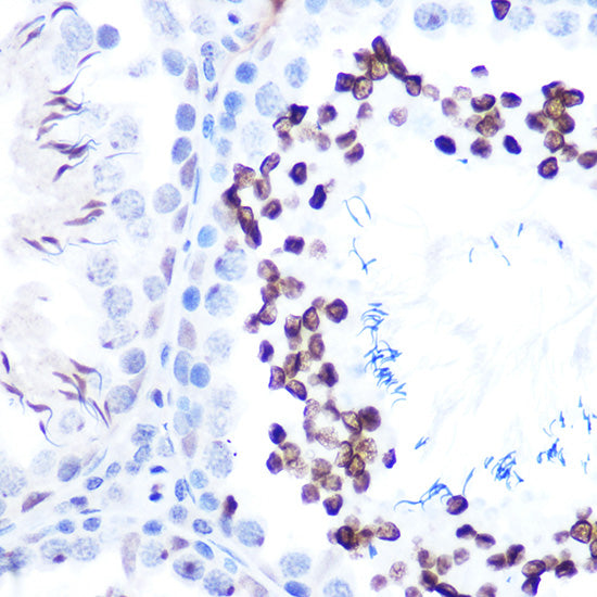 Phospho-STAT1-S727 Rabbit mAb
