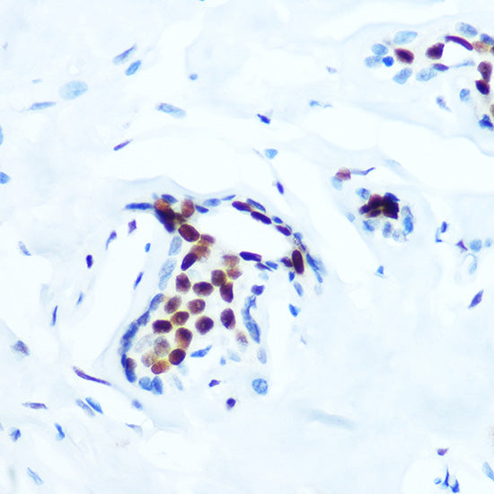 Phospho-c-Jun-T91 Rabbit mAb