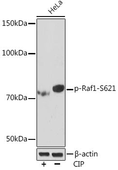 Phospho-Raf1-S621 Rabbit mAb
