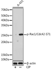 Phospho-Rac1/Cdc42-S71 Rabbit mAb