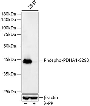 Phospho-PDHA1-S293 Rabbit mAb