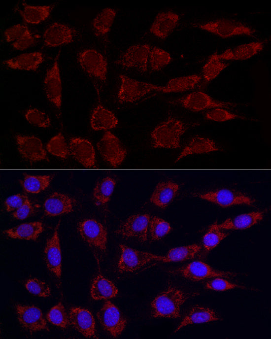 Phospho-PDHA1-S293 Rabbit mAb