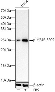 Phospho-eIF4E-S209 Rabbit mAb