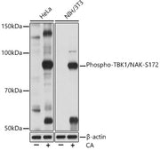 Phospho-TBK1/NAK-S172 Rabbit mAb
