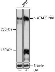 Phospho-ATM-S1981 Rabbit mAb