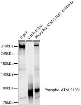 Phospho-ATM-S1981 Rabbit mAb