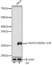 Phospho-HSP27/HSPB1-S78 Rabbit mAb