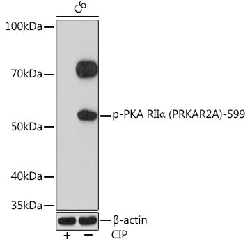 Phospho-PKA RIIα (PRKAR2A)-S99 Rabbit mAb