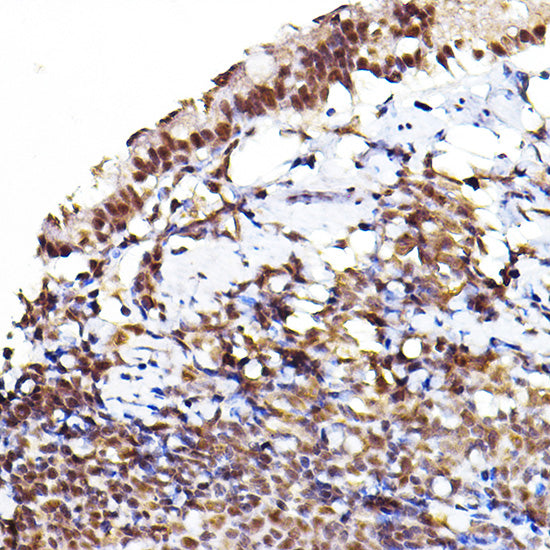 Phospho-Akt-S473 Rabbit pAb