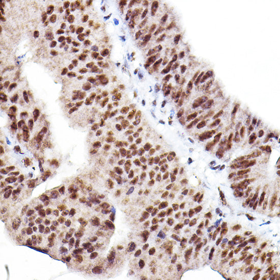 Phospho-Akt-S473 Rabbit pAb