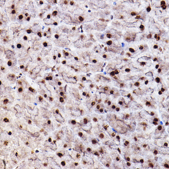 Phospho-Akt-S473 Rabbit pAb