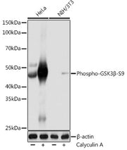 Phospho-GSK3β-S9 Rabbit mAb