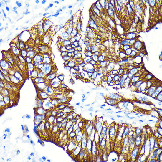 Phospho-GSK3β-S9 Rabbit mAb