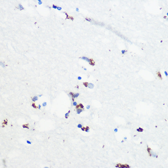 Phospho-Tau-Ser416 Rabbit pAb