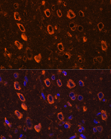 Phospho-Tau-Ser416 Rabbit pAb