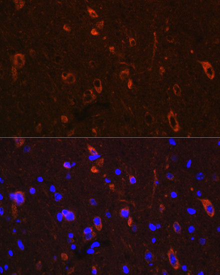Phospho-Tau-Ser416 Rabbit pAb
