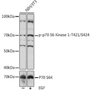 Phospho-p70 S6 Kinase 1-T421/S424 Rabbit pAb