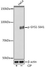 Phospho-GYS1-S641 Rabbit mAb