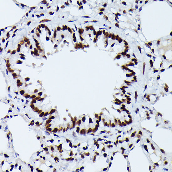Phospho-NRF2-S40 Rabbit mAb