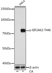 Phospho-PKR/EIF2AK2-T446 Rabbit mAb