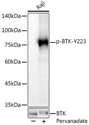 Phospho-BTK-Y223 Rabbit mAb