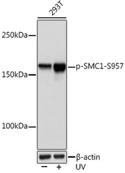 Phospho-SMC1-S957 Rabbit mAb