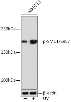Phospho-SMC1-S957 Rabbit mAb