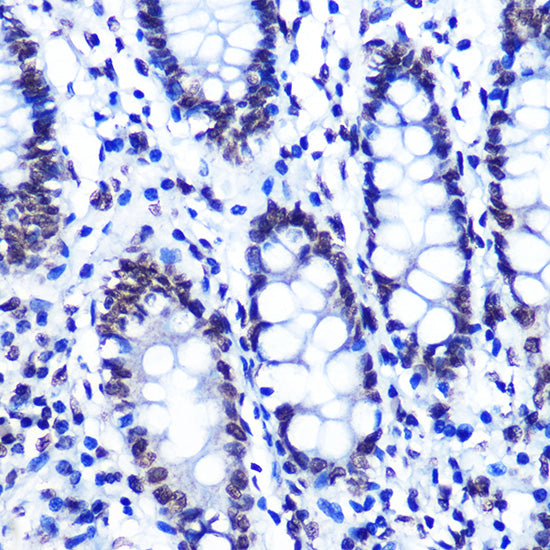 Phospho-SMC1-S957 Rabbit mAb