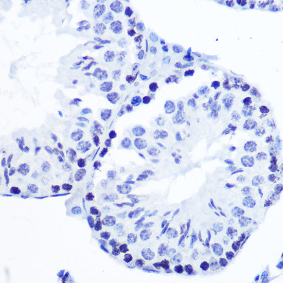 Phospho-SMC1-S957 Rabbit mAb