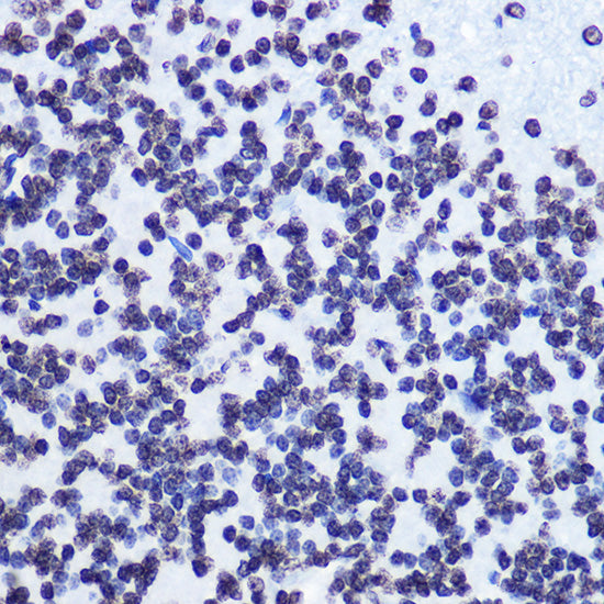 Phospho-SMC1-S957 Rabbit mAb