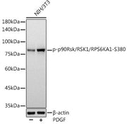Phospho-p90Rsk/RSK1/RPS6KA1-S380 Rabbit mAb