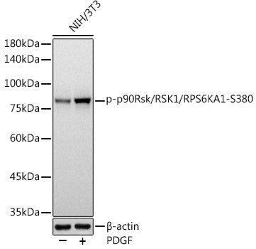 Phospho-p90Rsk/RSK1/RPS6KA1-S380 Rabbit mAb