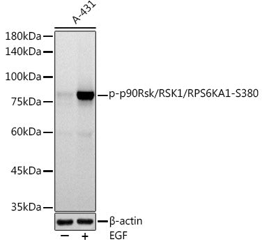 Phospho-p90Rsk/RSK1/RPS6KA1-S380 Rabbit mAb