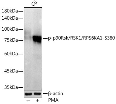 Phospho-p90Rsk/RSK1/RPS6KA1-S380 Rabbit mAb